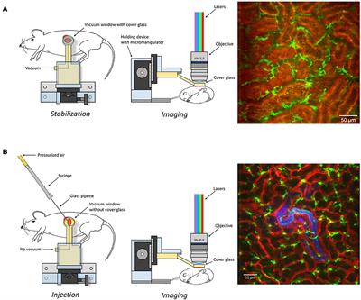 High Resolution Intravital Imaging of the Renal Immune Response to Injury and Infection in Mice